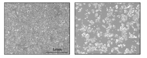 תצלום מיקרוסקופ של תאים רגילים, המייצרים את החלבון DAP5 (משמאל), לעומת תאים מהונדסים, שאינם מייצרים את החלבון (מימין). כמות התאים המהונדסים קטנה בהרבה, משום שבהיעדר DAP5 יכולת ההישרדות שלהם נפגעת